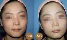 徒手祛斑爆料视频大全下载,视频大全下载攻略